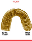 OPRO Gold level Tannbeskytter - Svart/Gull