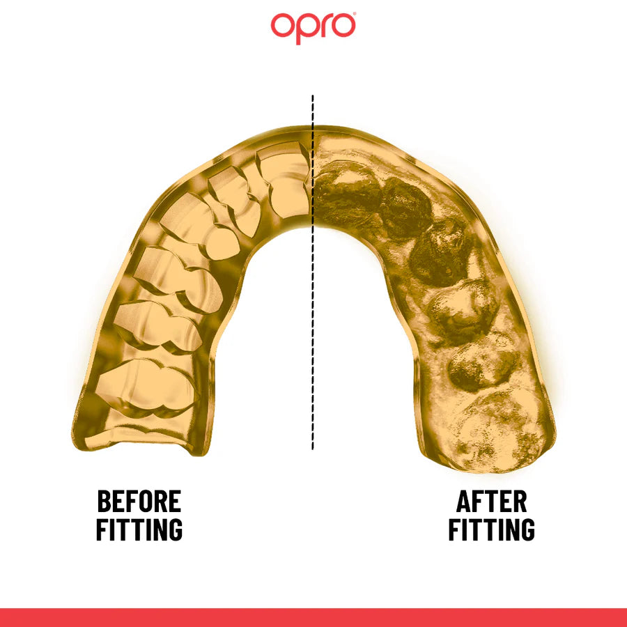 OPRO Instant Custom Fit Mouthguard - White